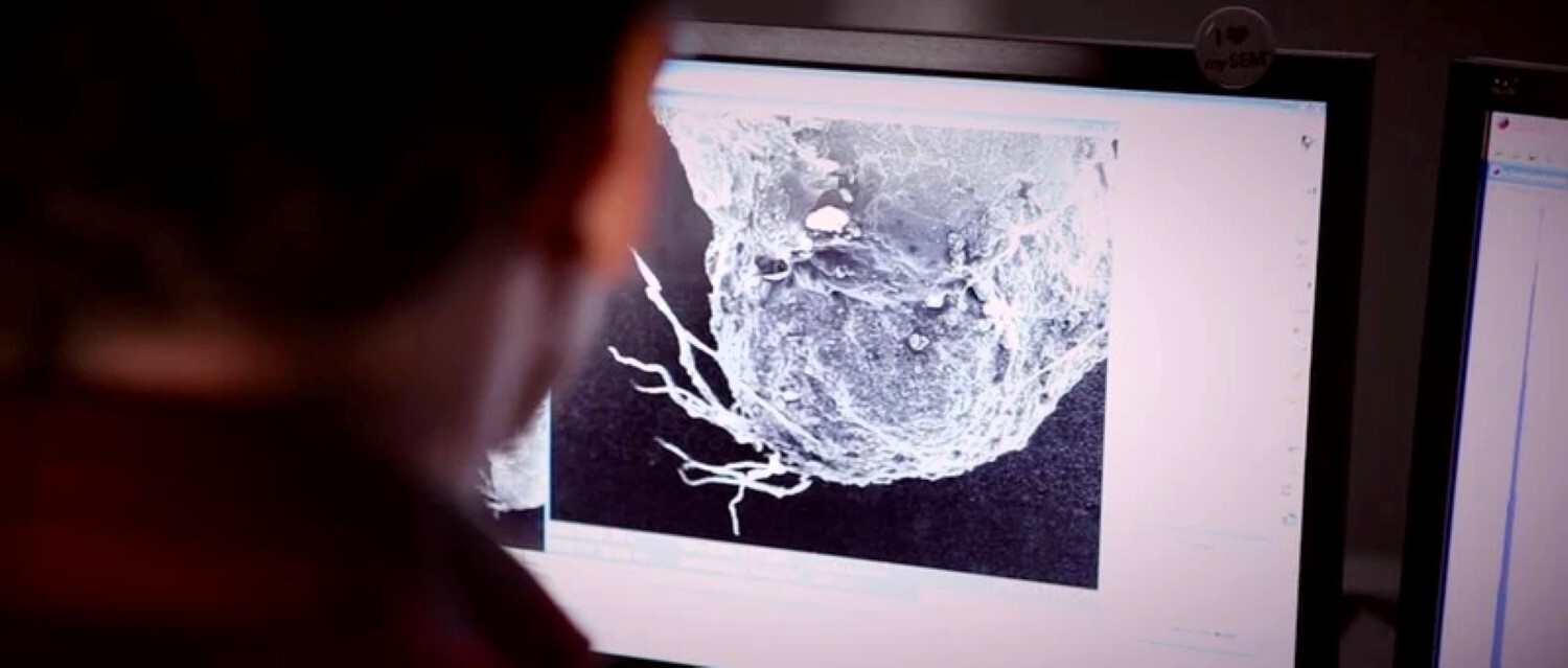 Le chirurgien qui affirme débarrasser ses patients d'implants extraterrestres