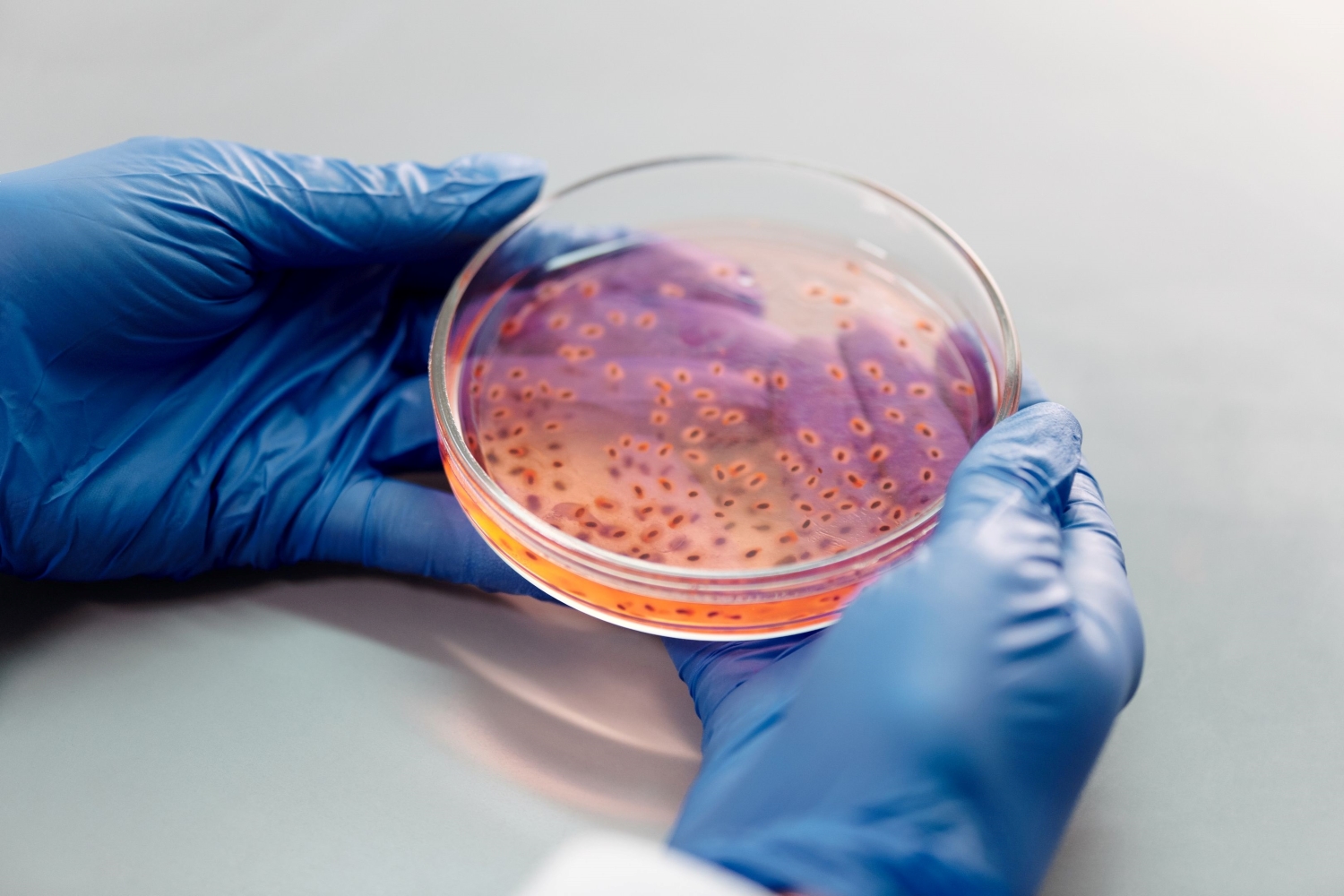 Une bactérie mangeuse de chair potentiellement mortelle prolifère dans les océans du monde entier